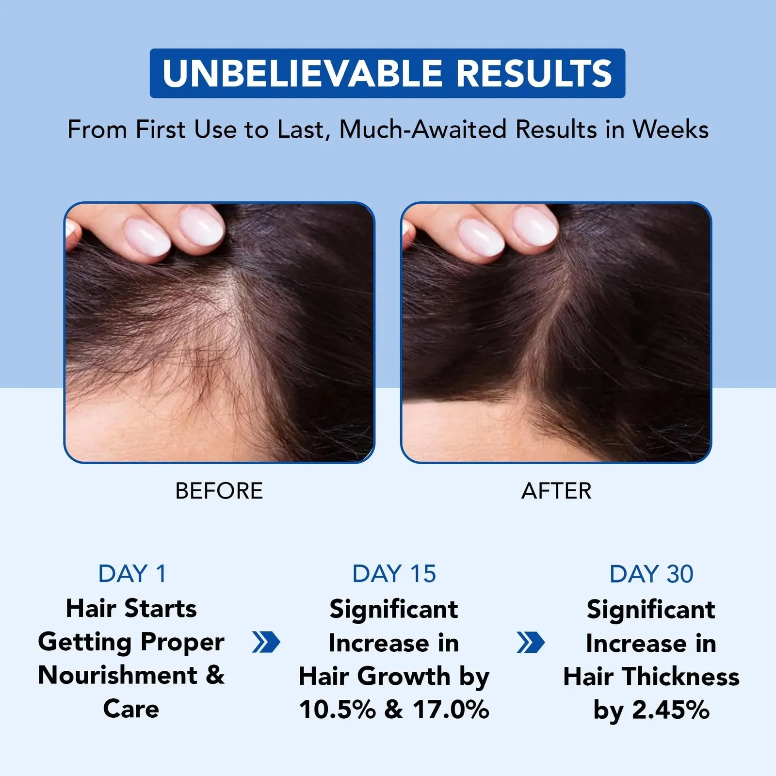 Rosemary Oil for Hair Growth
