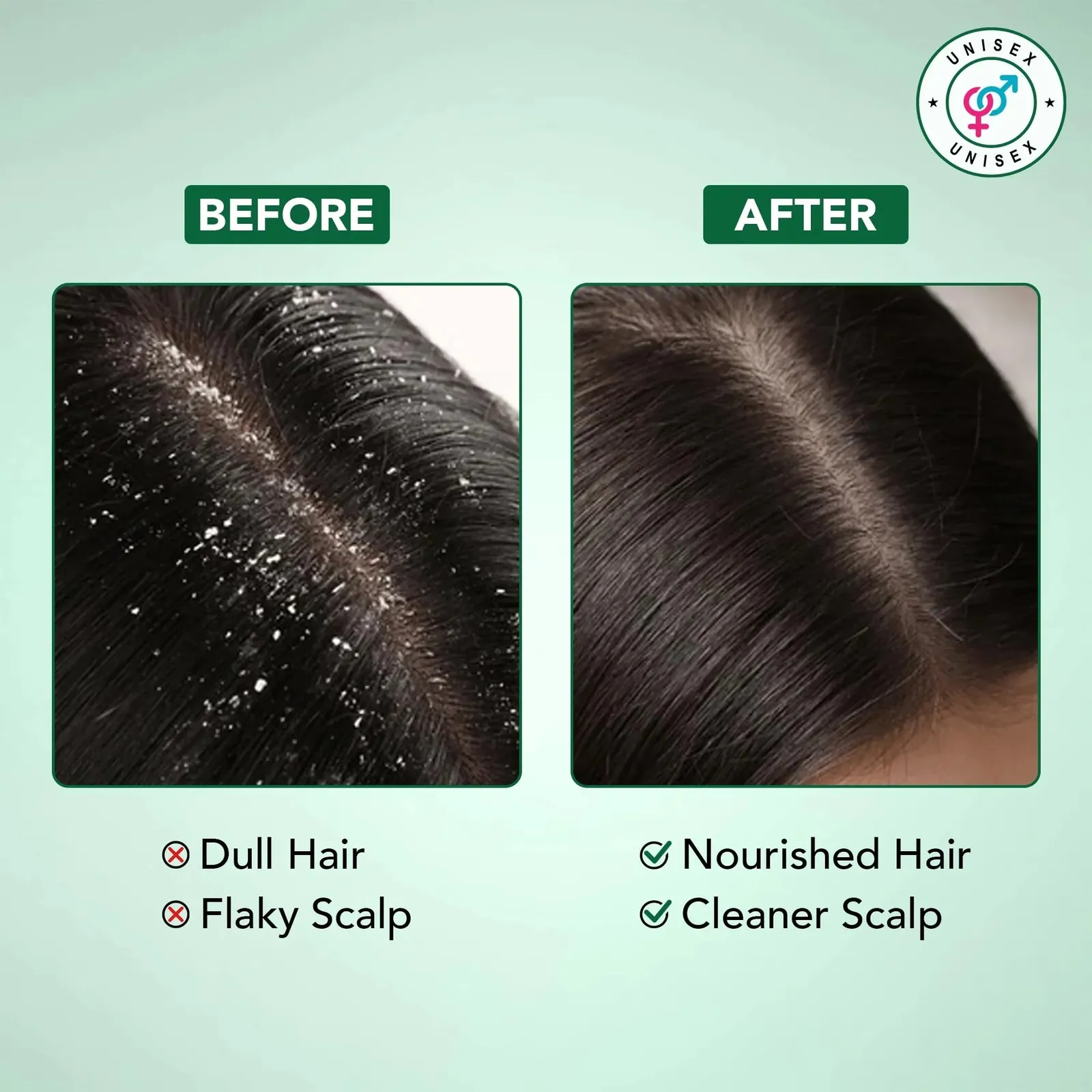 Tea Tree Shampoo and Conditioner Set