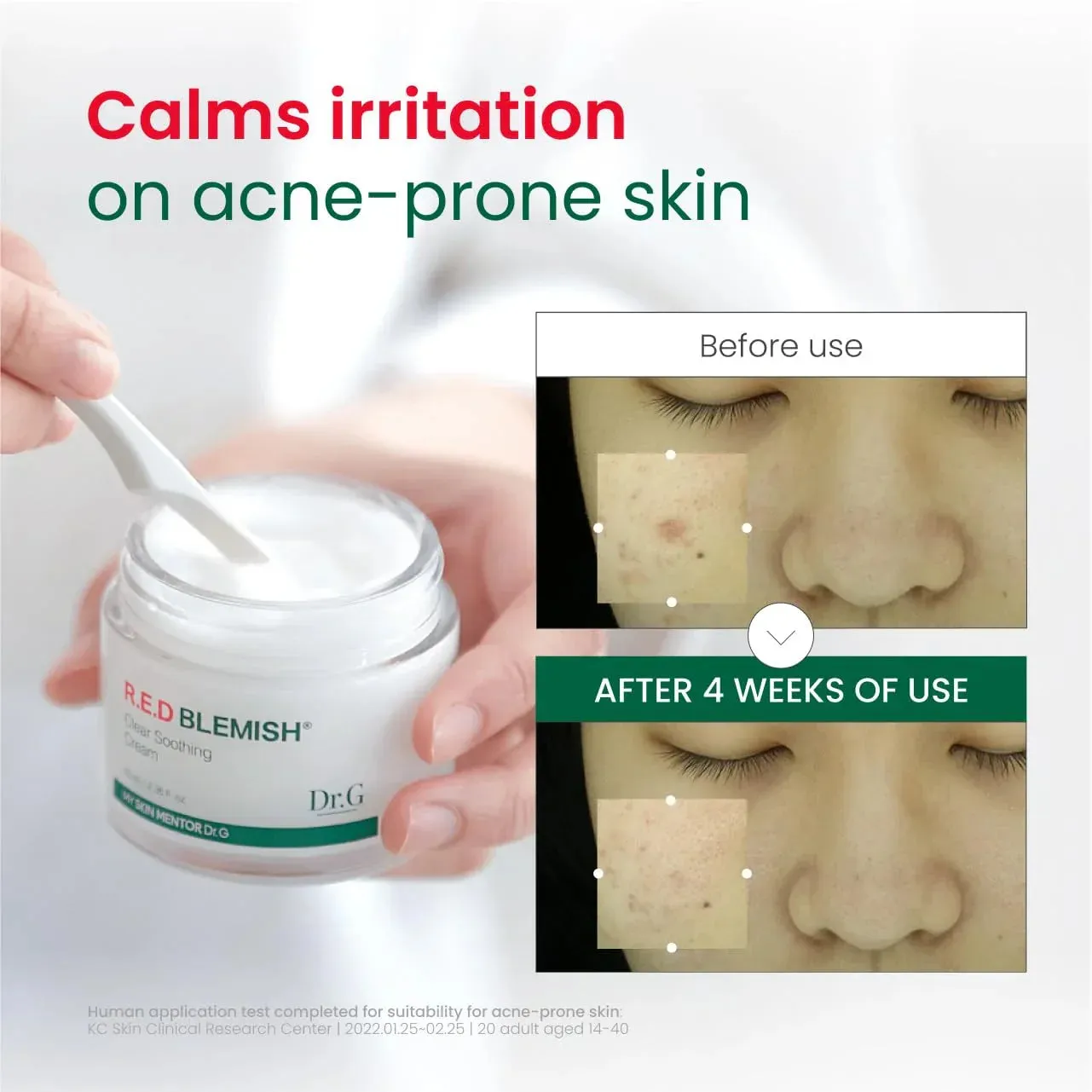 R.E.D. Blemish Clear Soothing Cream - Calming Korean Moisturizer for Redness