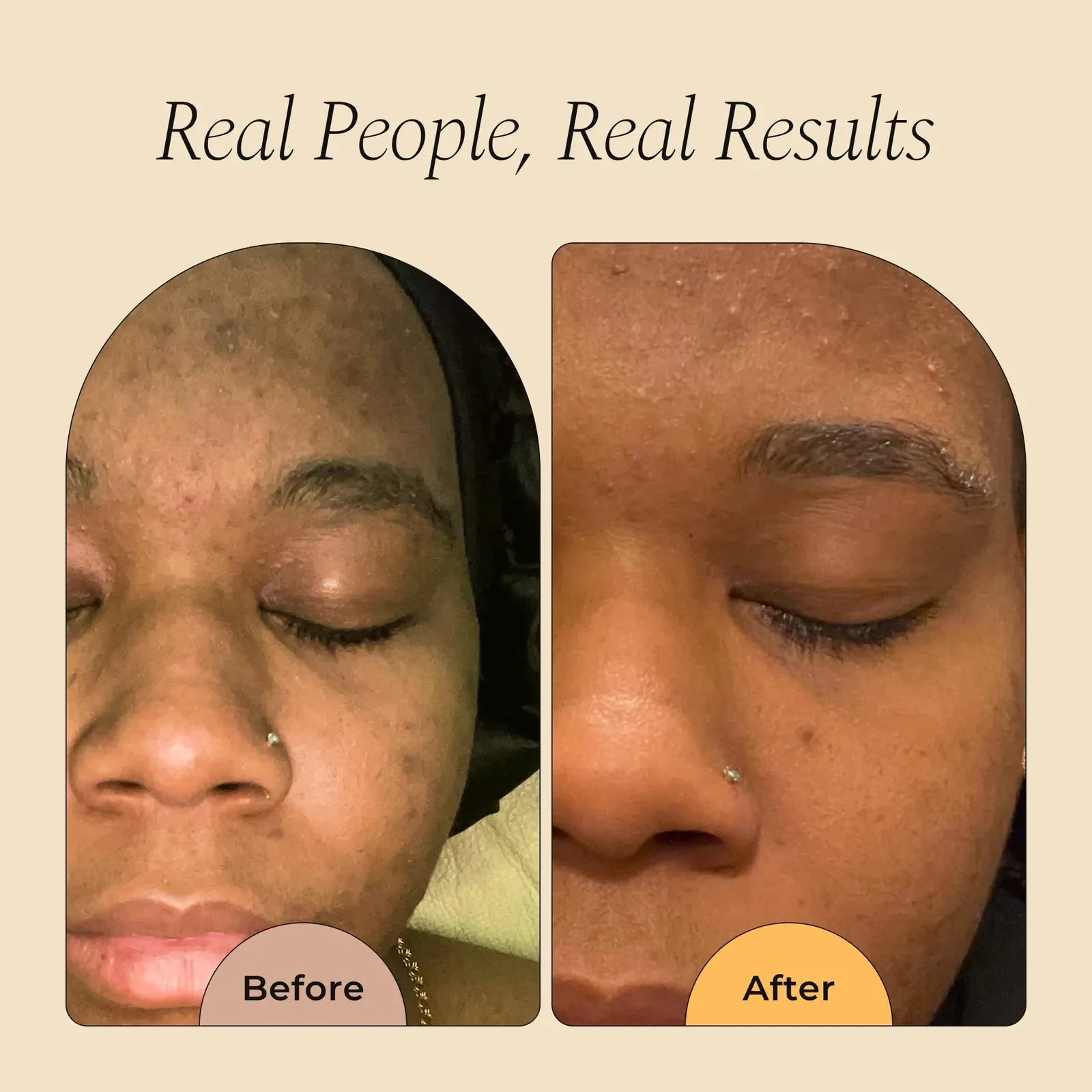 Turmeric Soap for Face