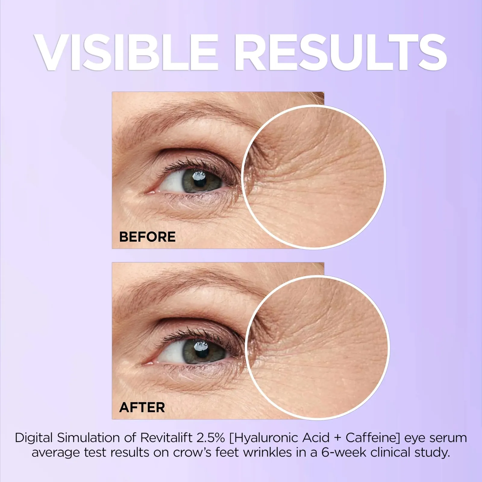 Revitalift Hyaluronic Acid + Caffeine Hydrating Eye Serum