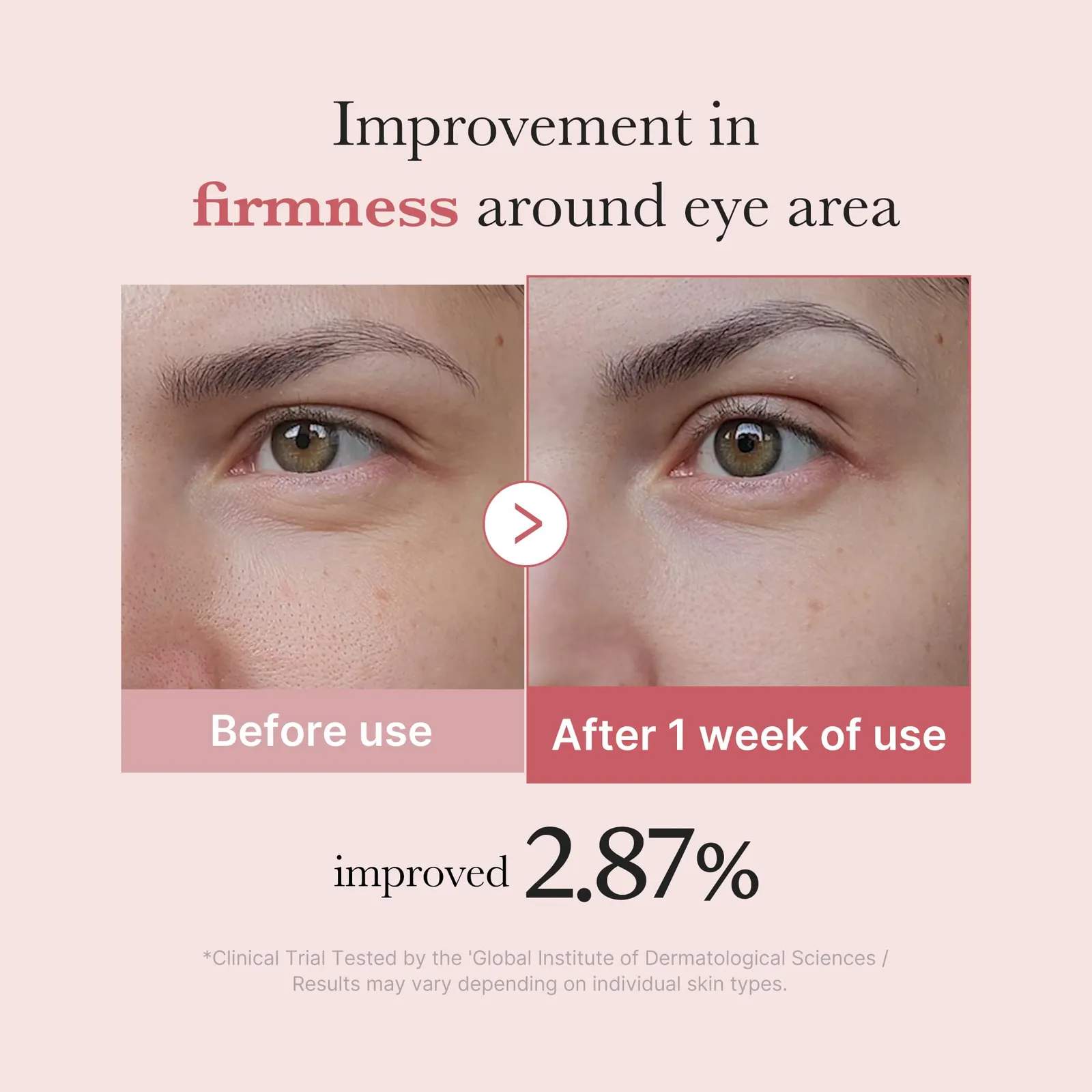 Eye Serum