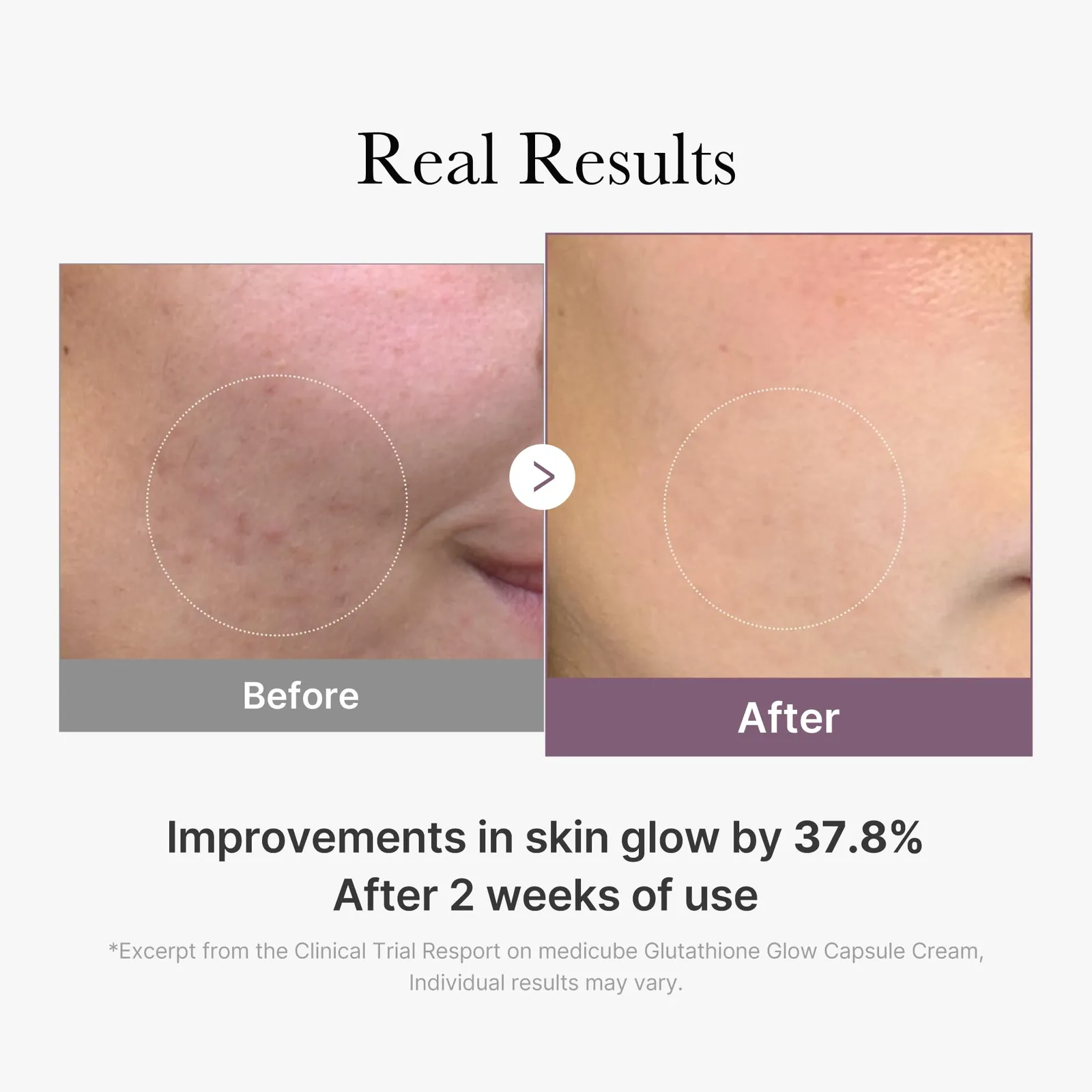 Glutathione Glow Capsule Facial Cream