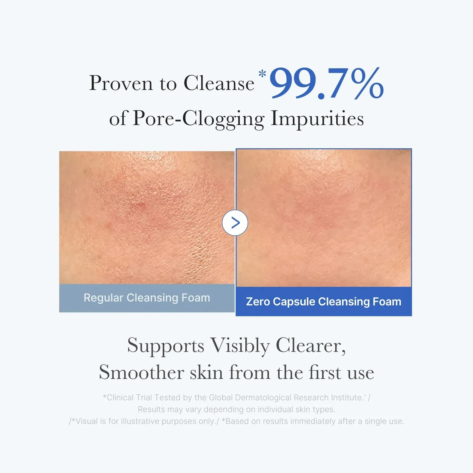 Zero Pore Clear Blue Capsule Facial Deep Cleanser