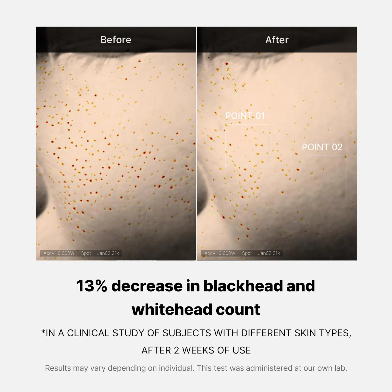 Medicube Zero Pore One-Day Serum