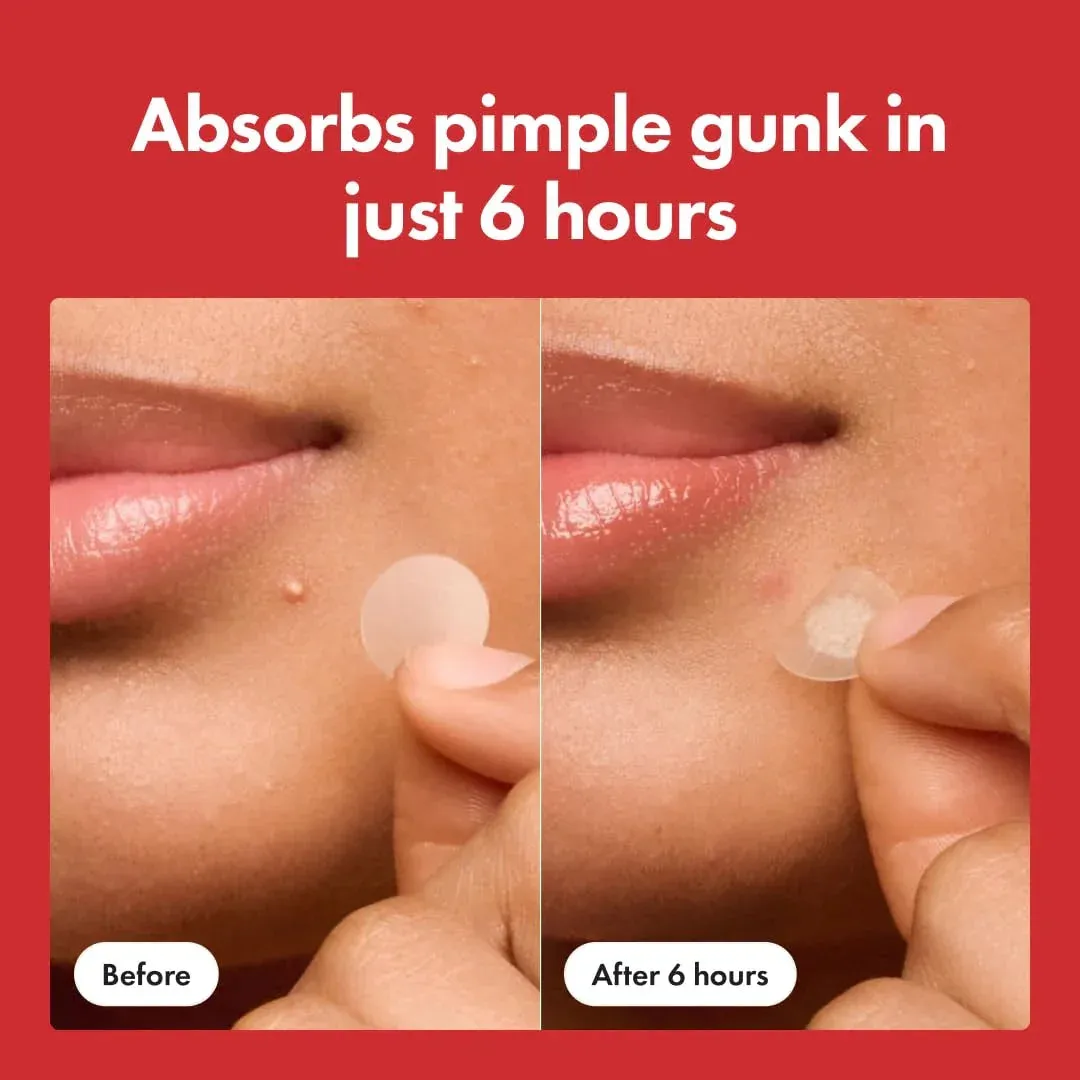 Original Acne Pimple Patch