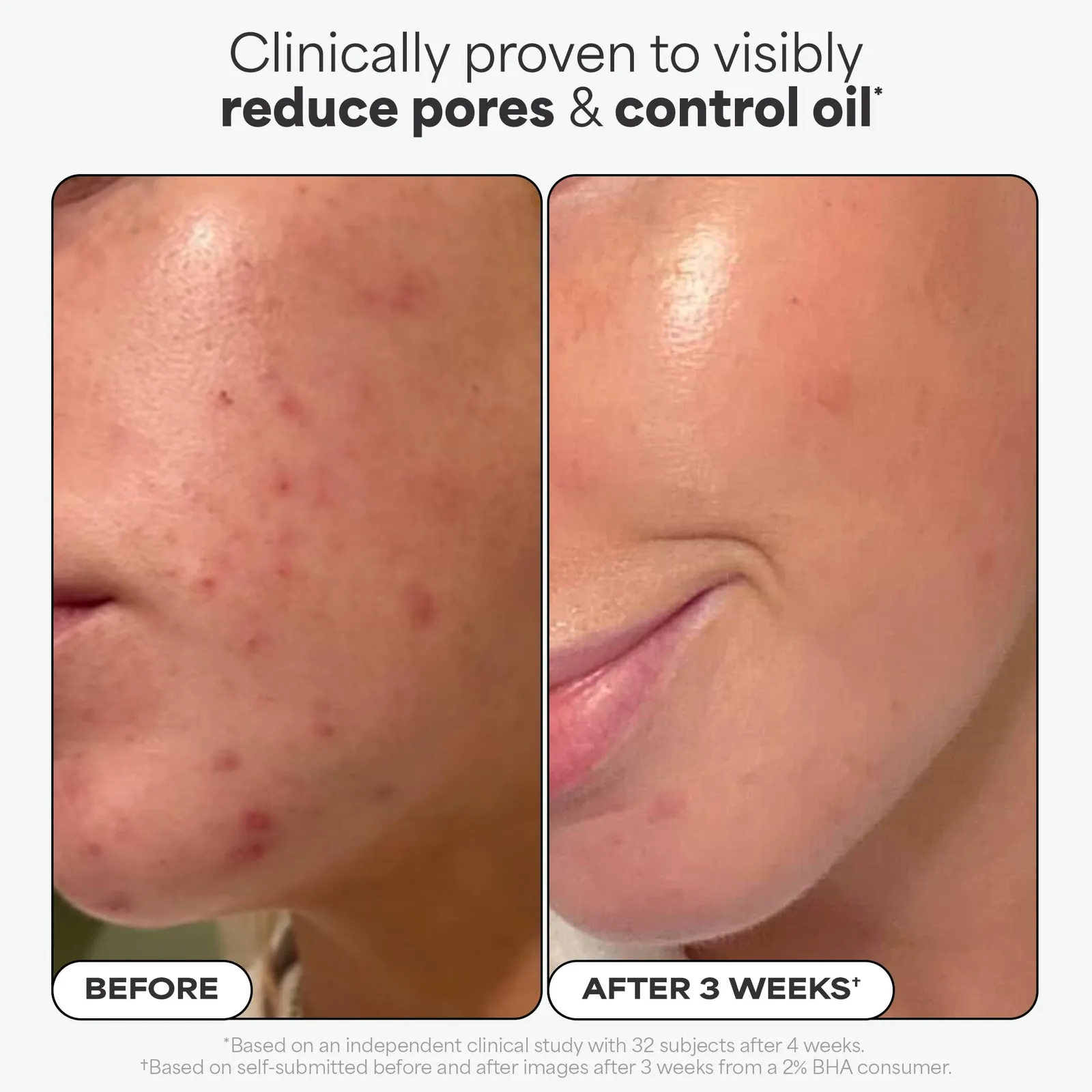 2% BHA Liquid Exfoliant