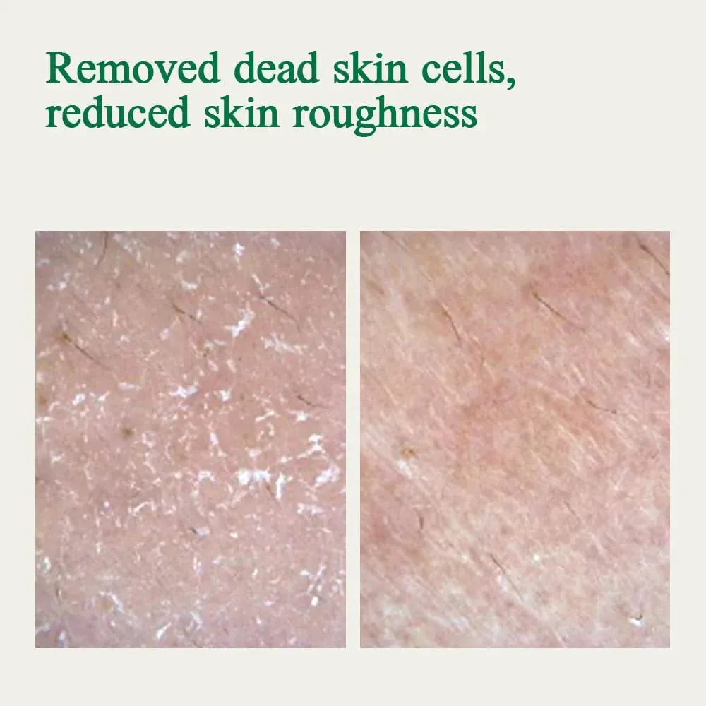 Ultimate Calming Solution Cream for Sensitive Skin - Calms & Soothes Redness with Cica & Tea Tree