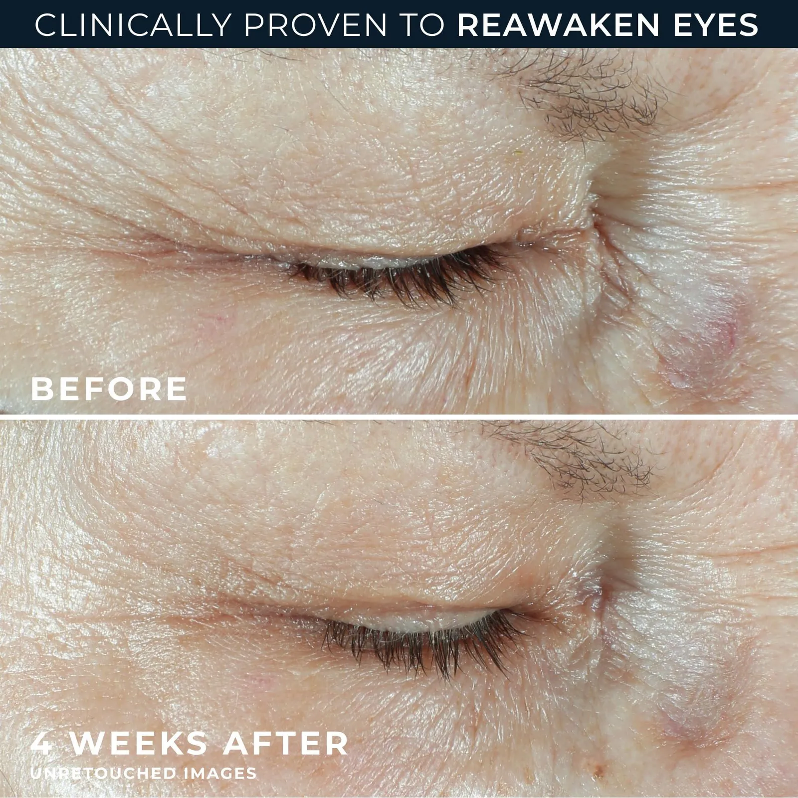 Multi Correxion Hyaluronic Acid Anti Aging Under Eye Cream