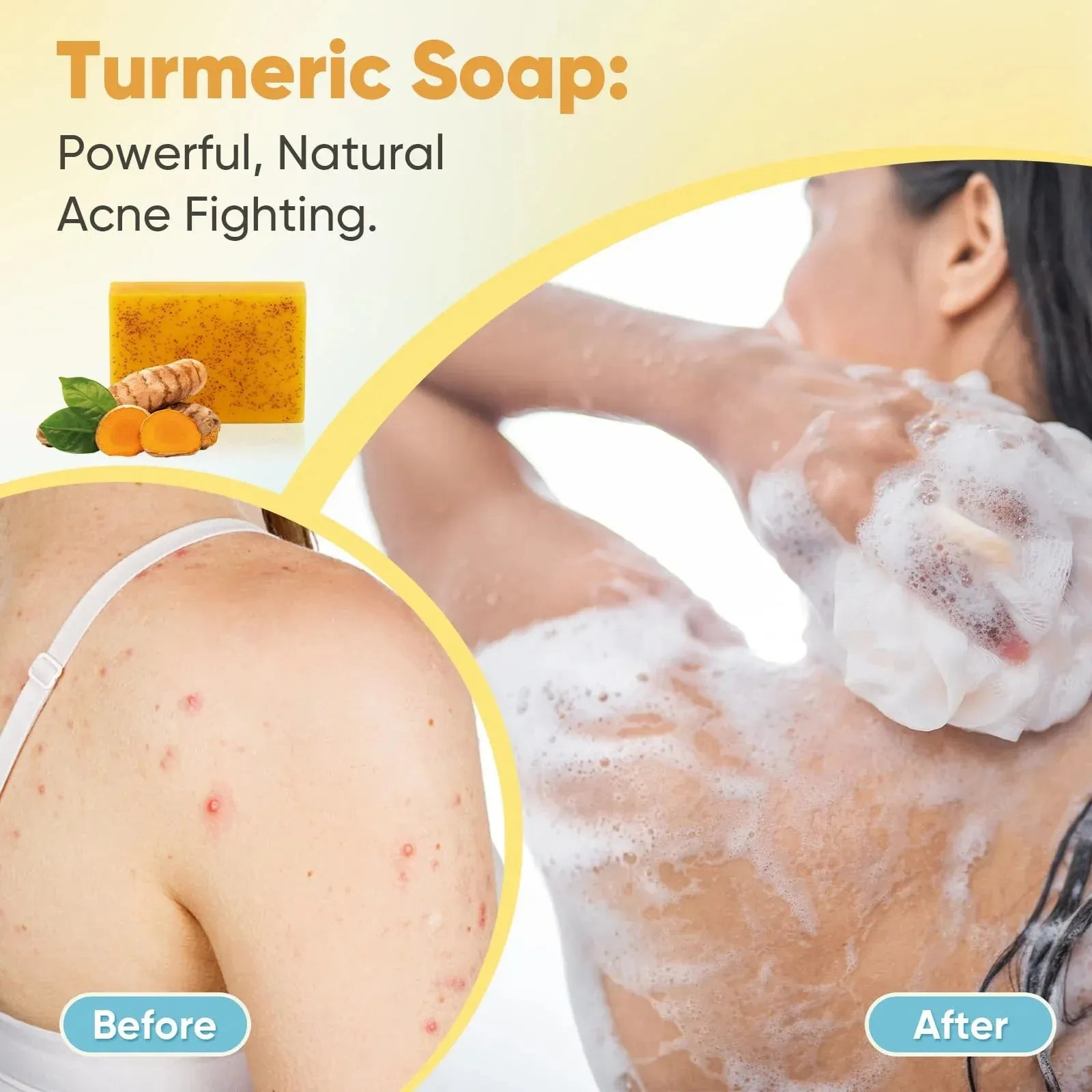 Turmeric & Kojic Acid Soap 5-Pack